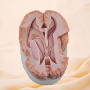 Modelo de silicona de anatomía ventricular