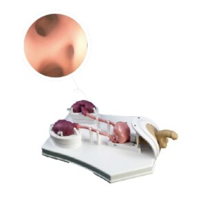 Modelo de entrenamiento en endoscopio urológico - MEE078